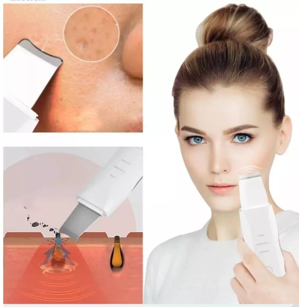 Espátula Facial Ultrasónica – Peeling, Lifting y Limpieza Profunda